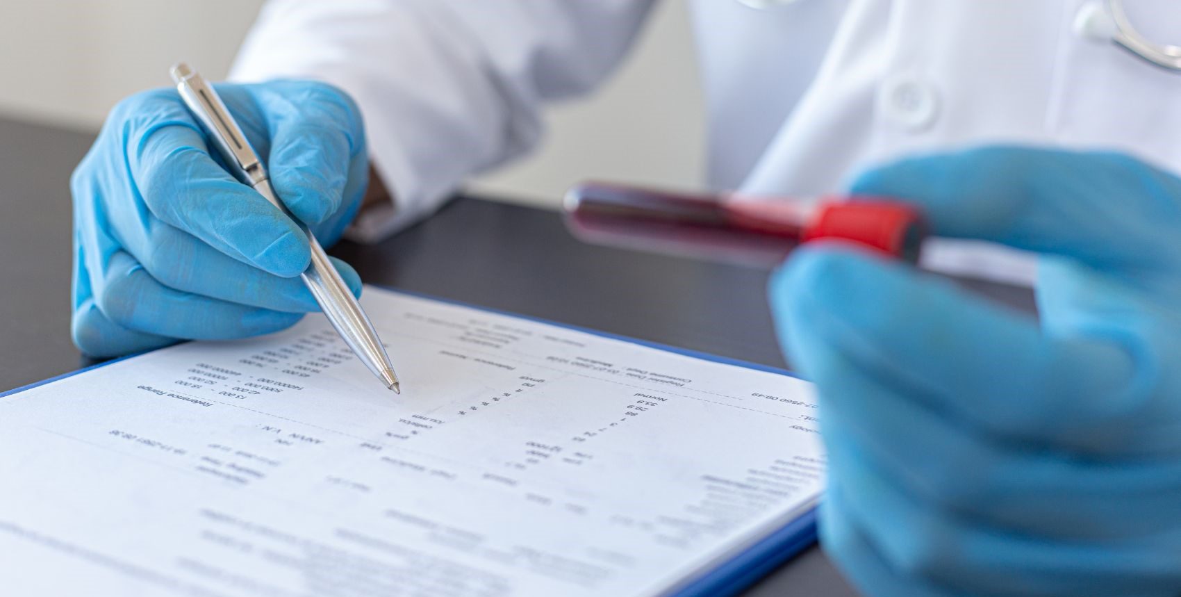 eritropoetina Fosfatase Ácida Prostática