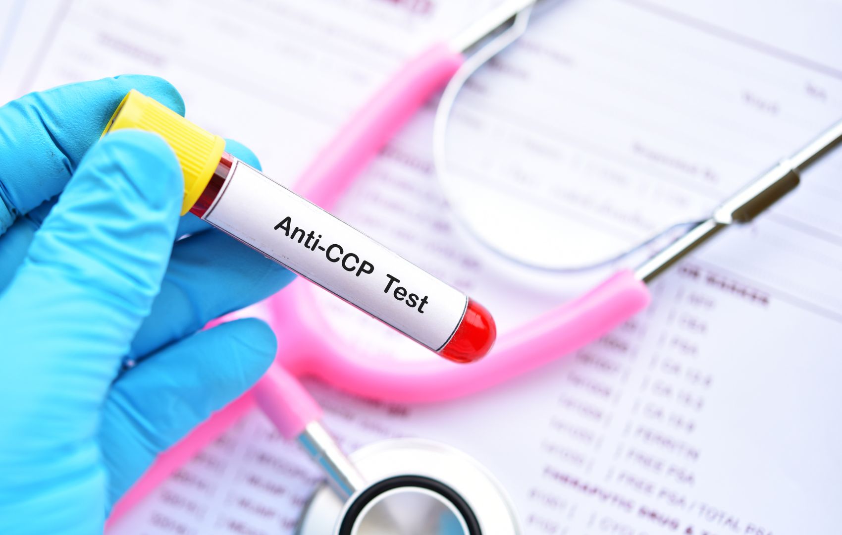 anticorpos anti ccp
