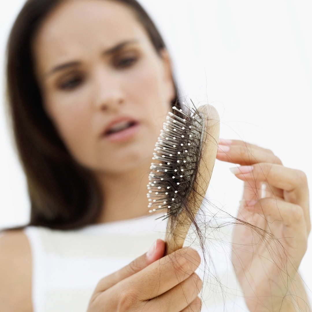 calvicie minoxidil oral