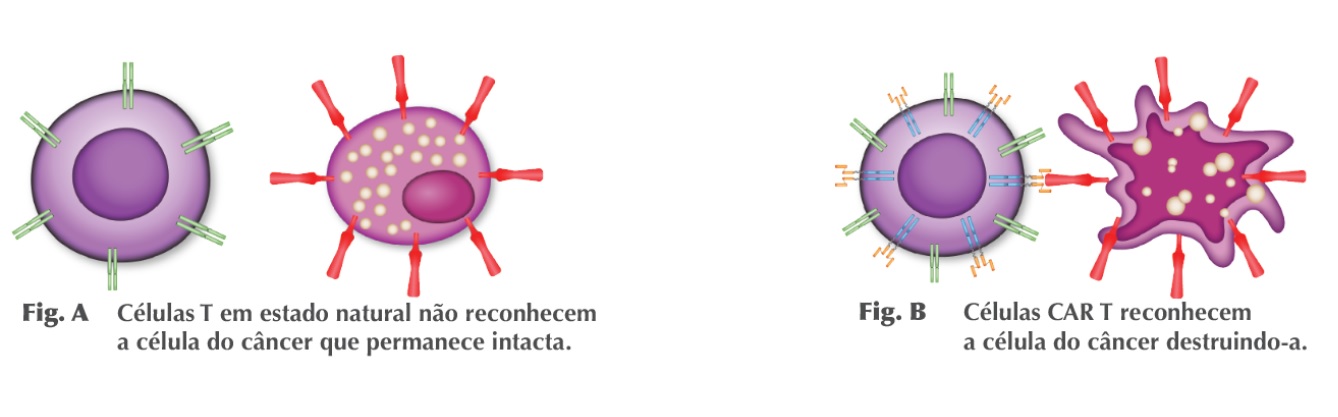 neoplasias car-t