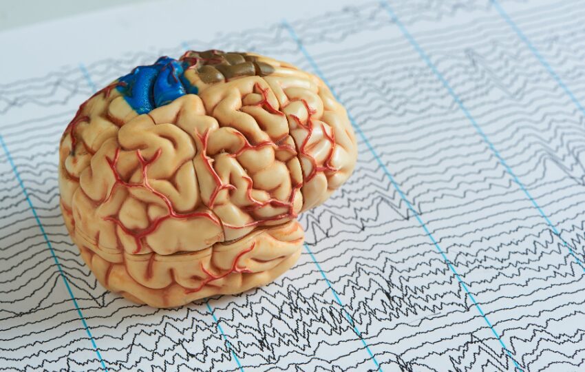 Epilepsia é mais do que convulsão. Entenda os tipos de crises, as principais síndromes epilépticas e as causas em cada fase da vida