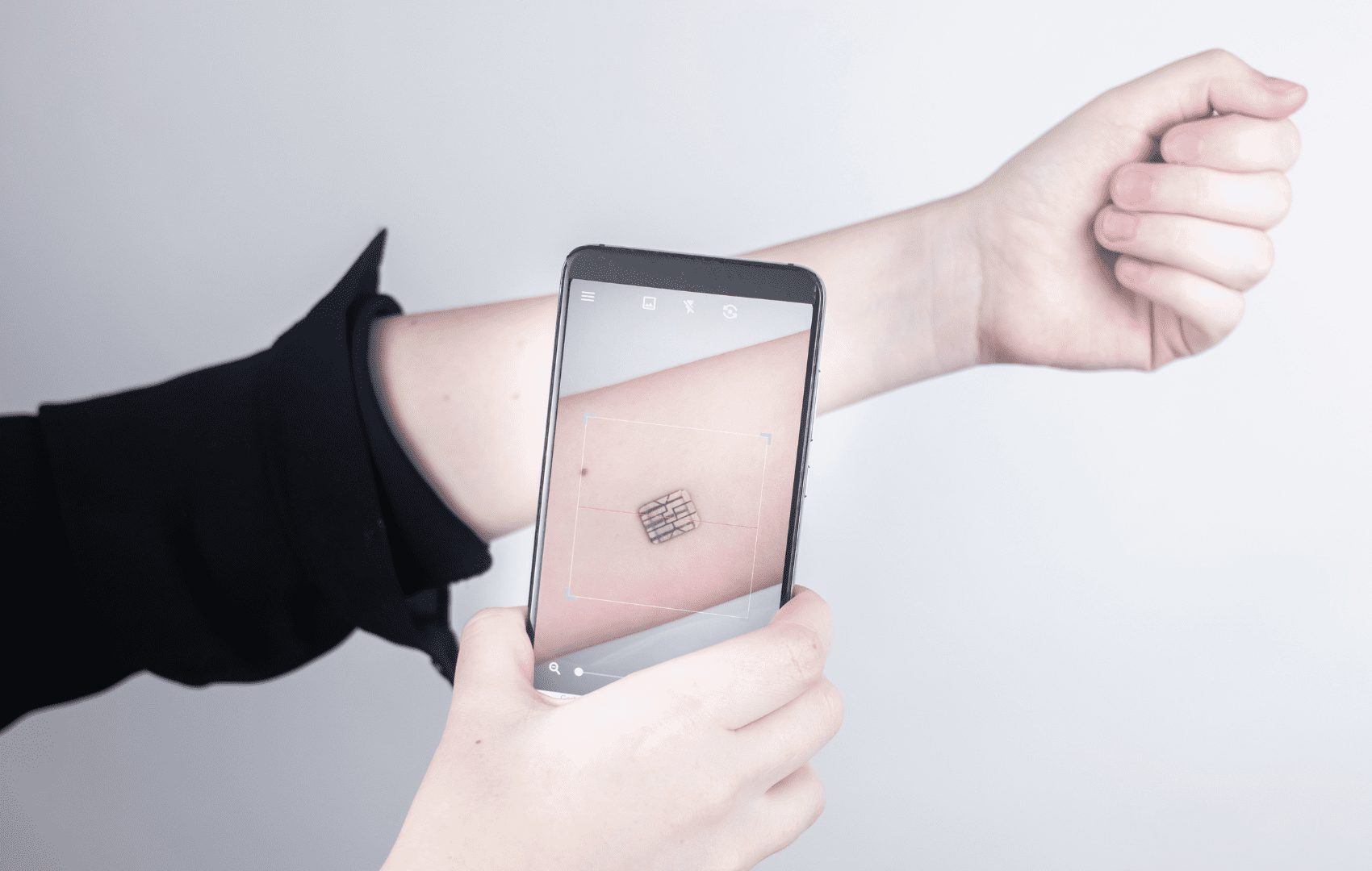 implantes hormonais chip da beleza