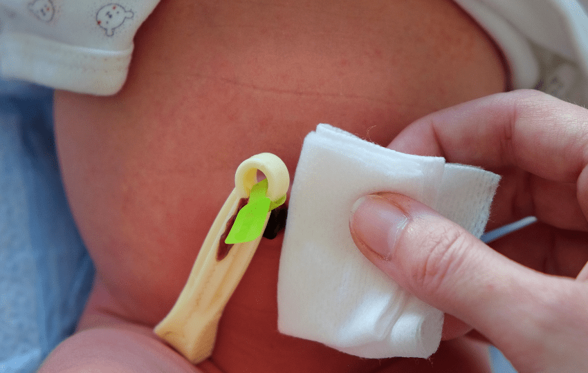 Aplicação de sal no Granuloma Umbilical