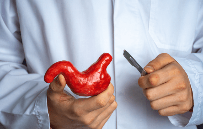 cirurgia bariátrica