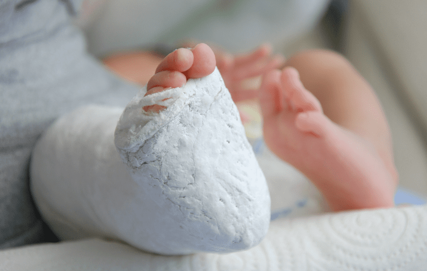 tratamento do pé torto congênito