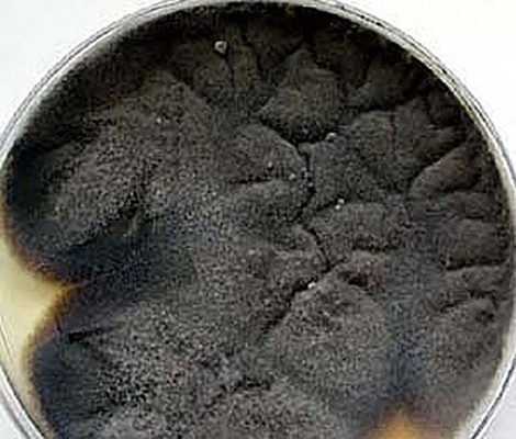 Feohifomicose por curvularia