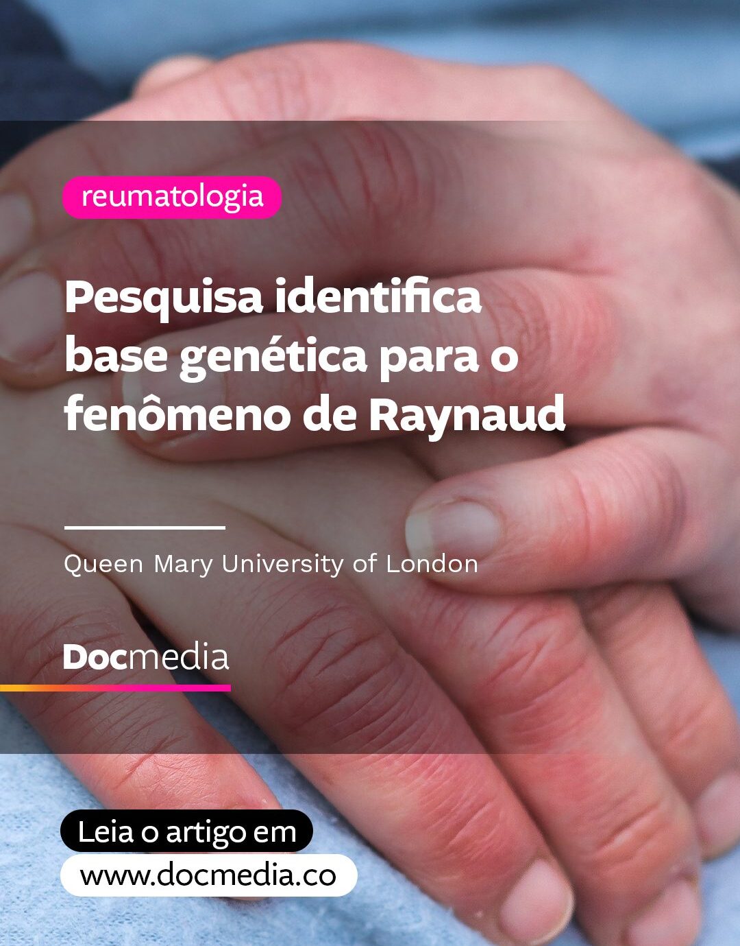 Fenômeno de Raynaud