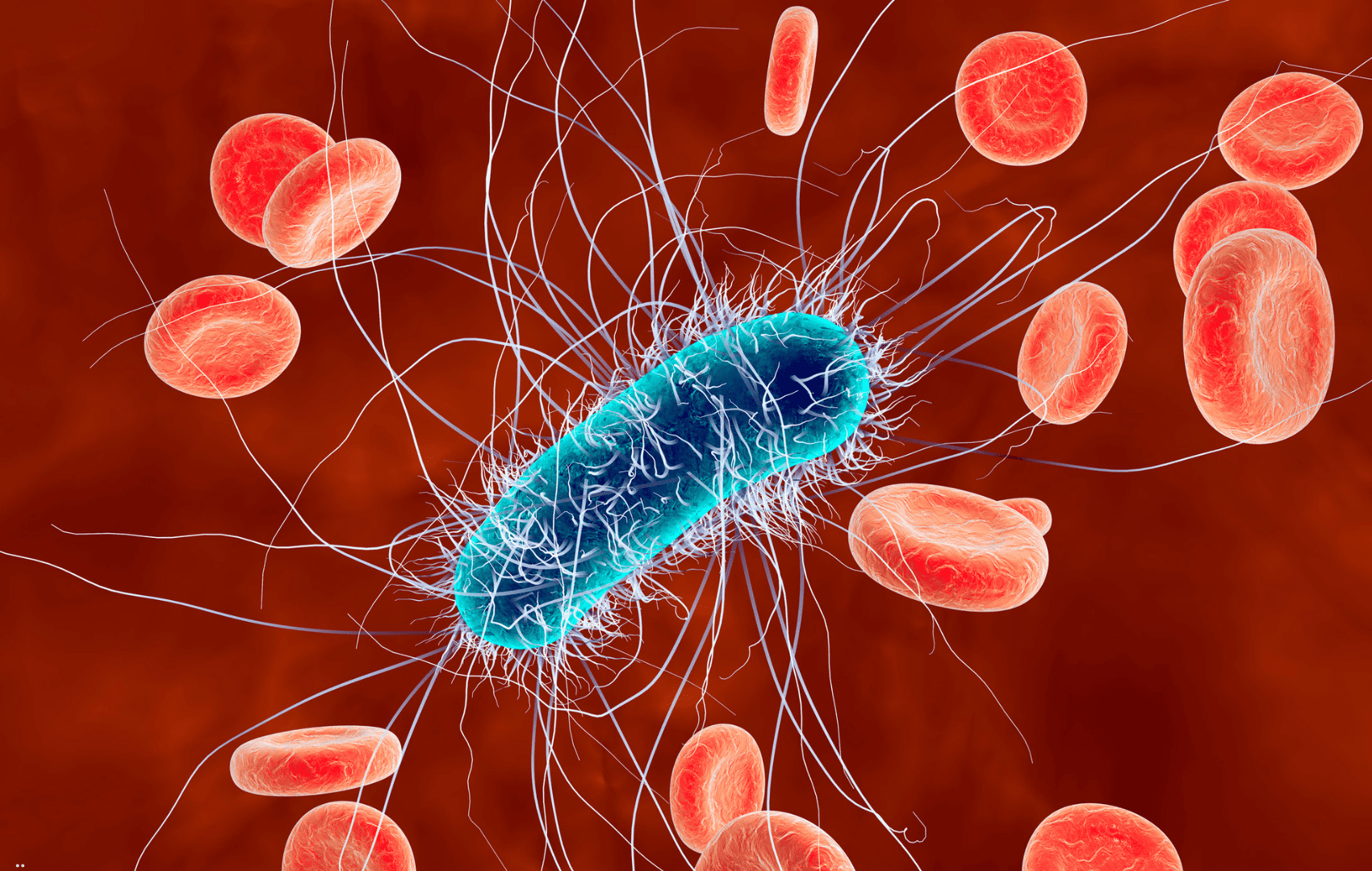 e coli uropatia obstrutiva infecciosa