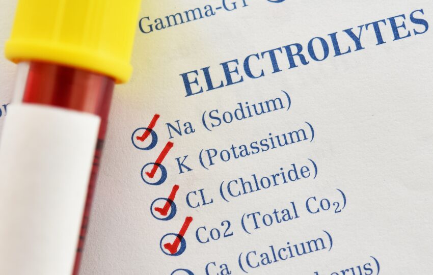 hiponatremia exame de sodio