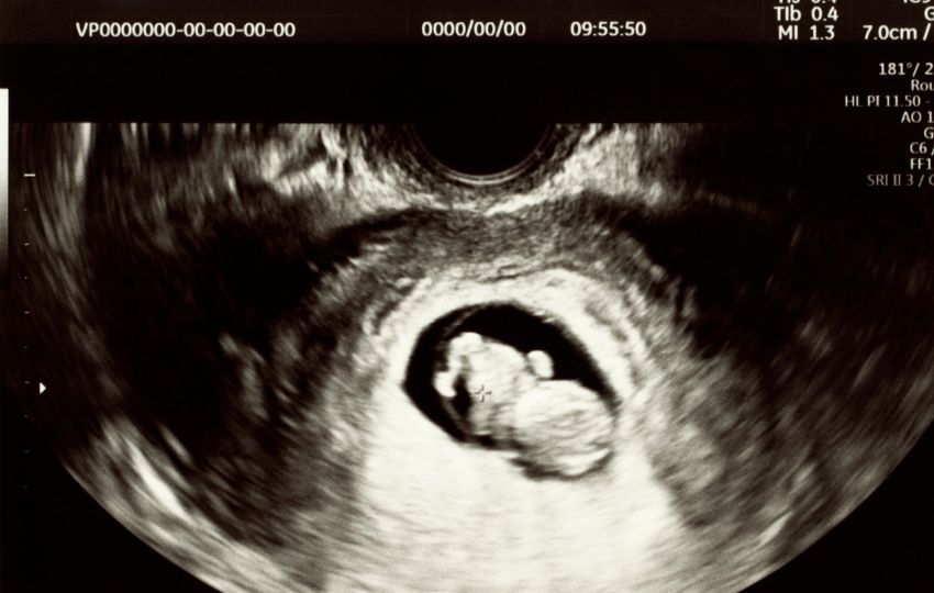 período periconcepcional