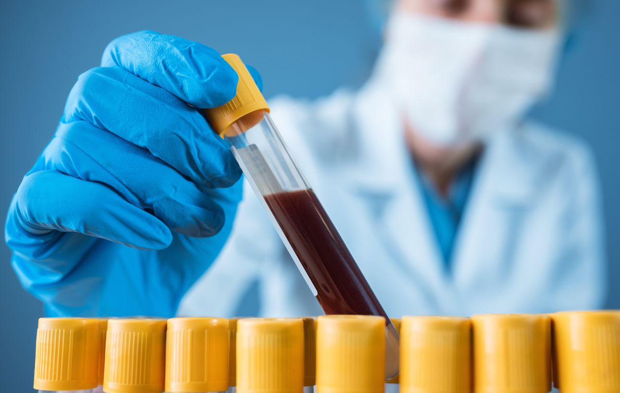 teste de coombs indireto depressão e inflamação