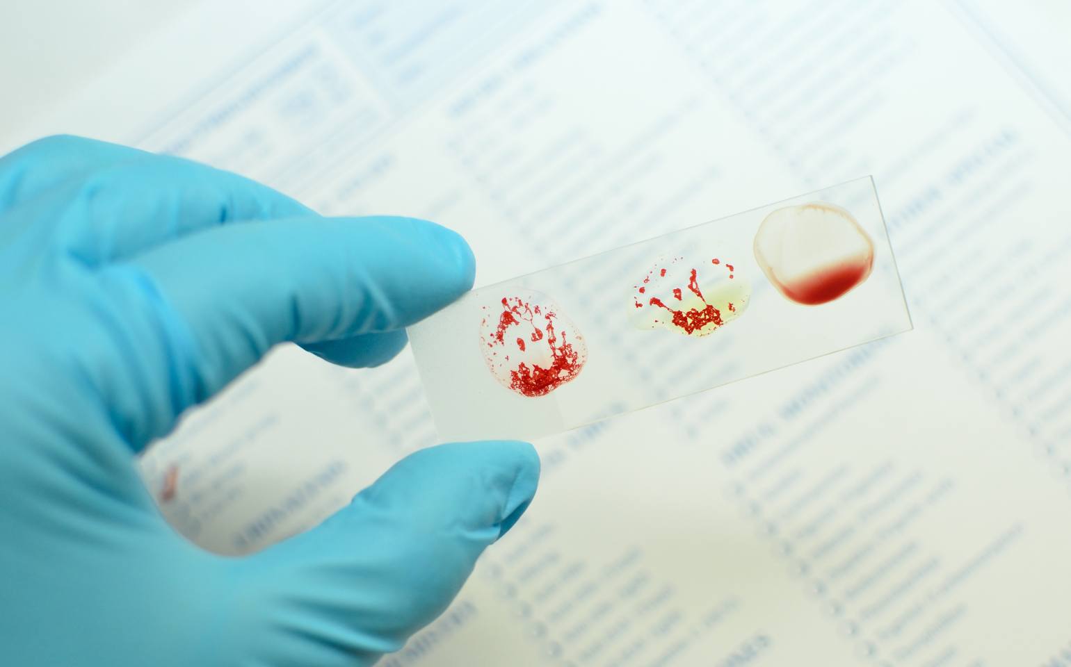 doação de sangue universal