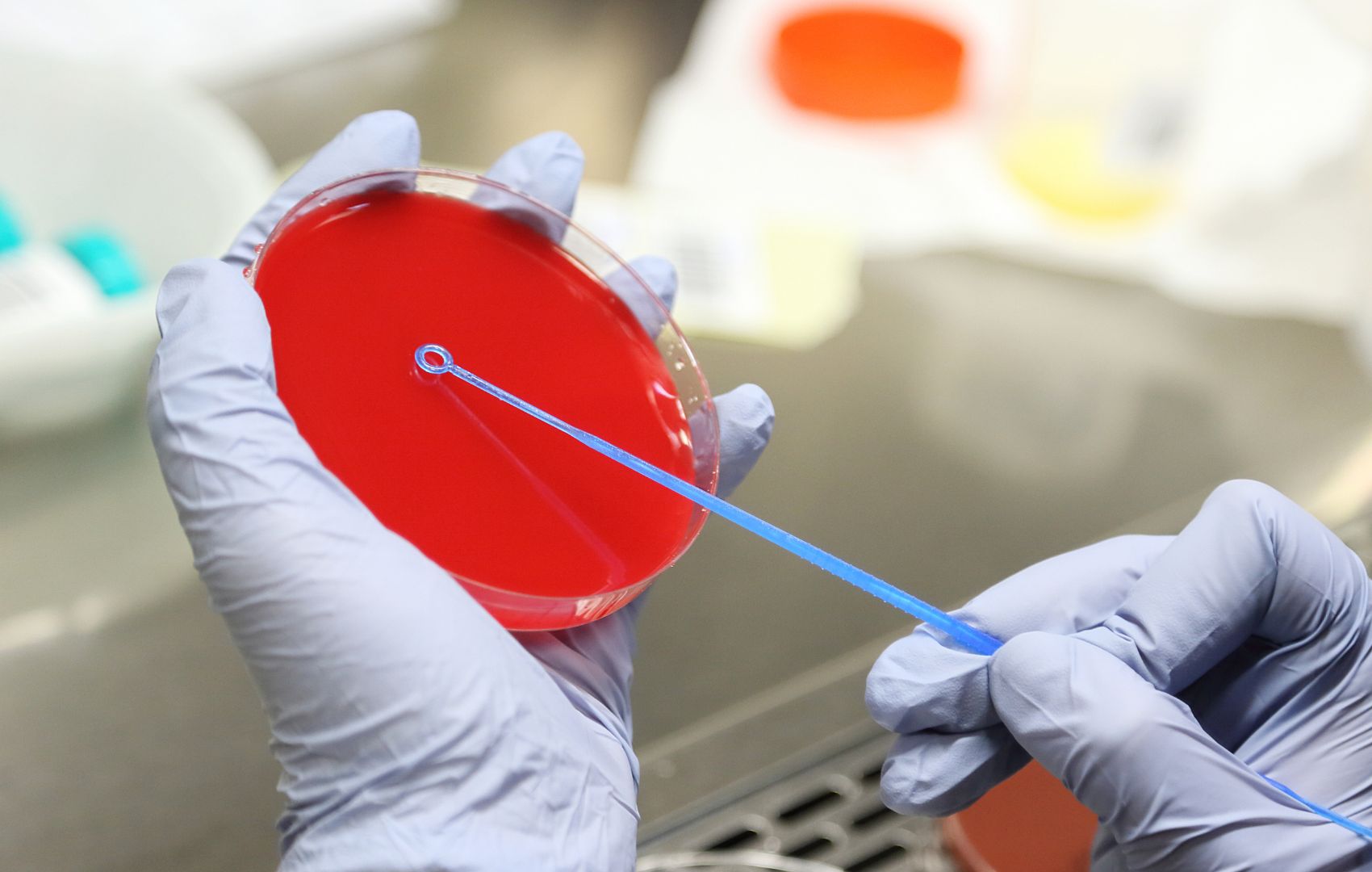 Arcanobacterium haemolyticum