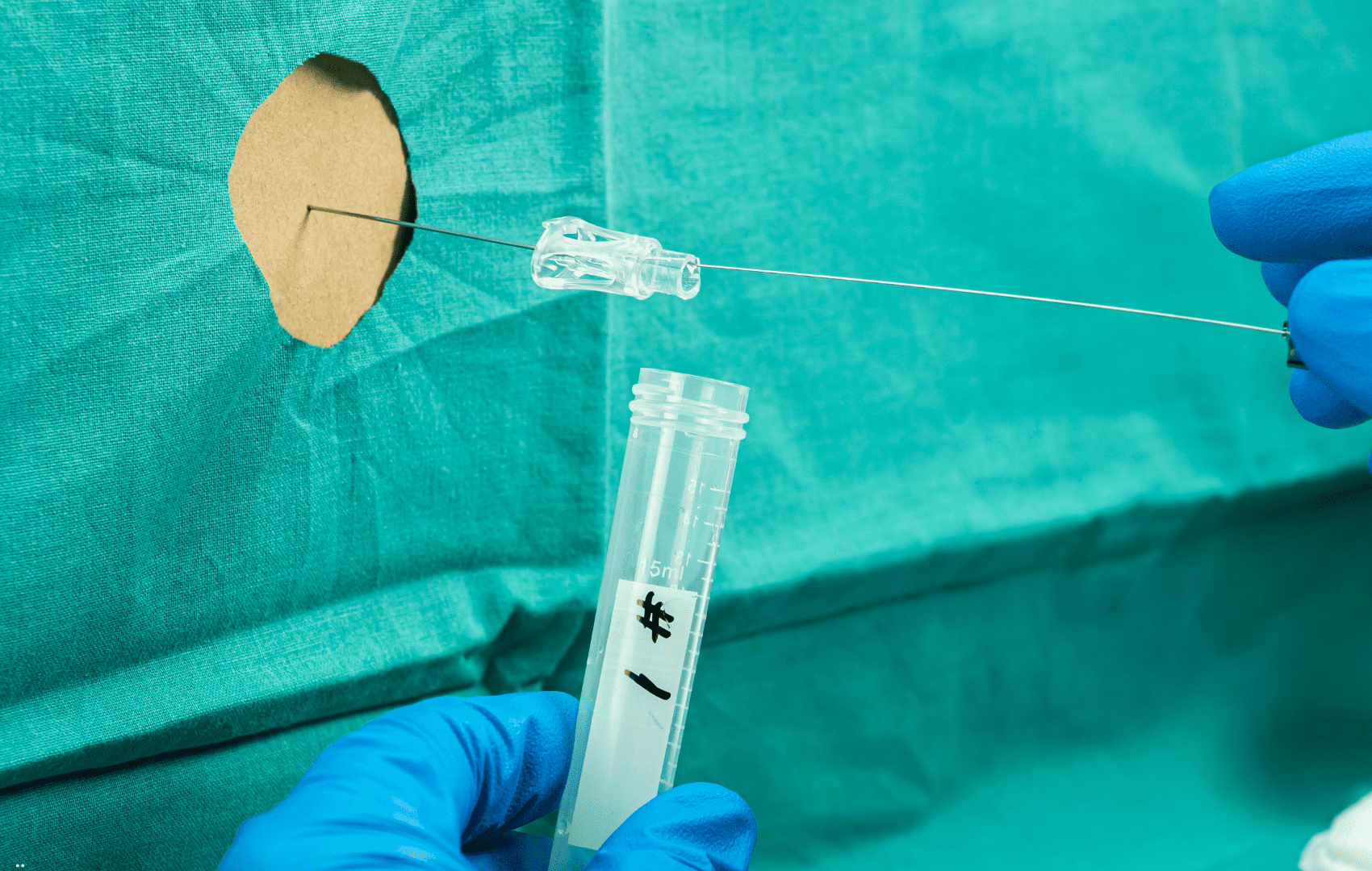 LCR arenavírus meningite