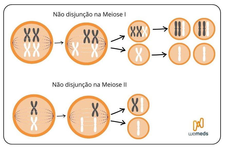 Síndrome de Down - não disjunção