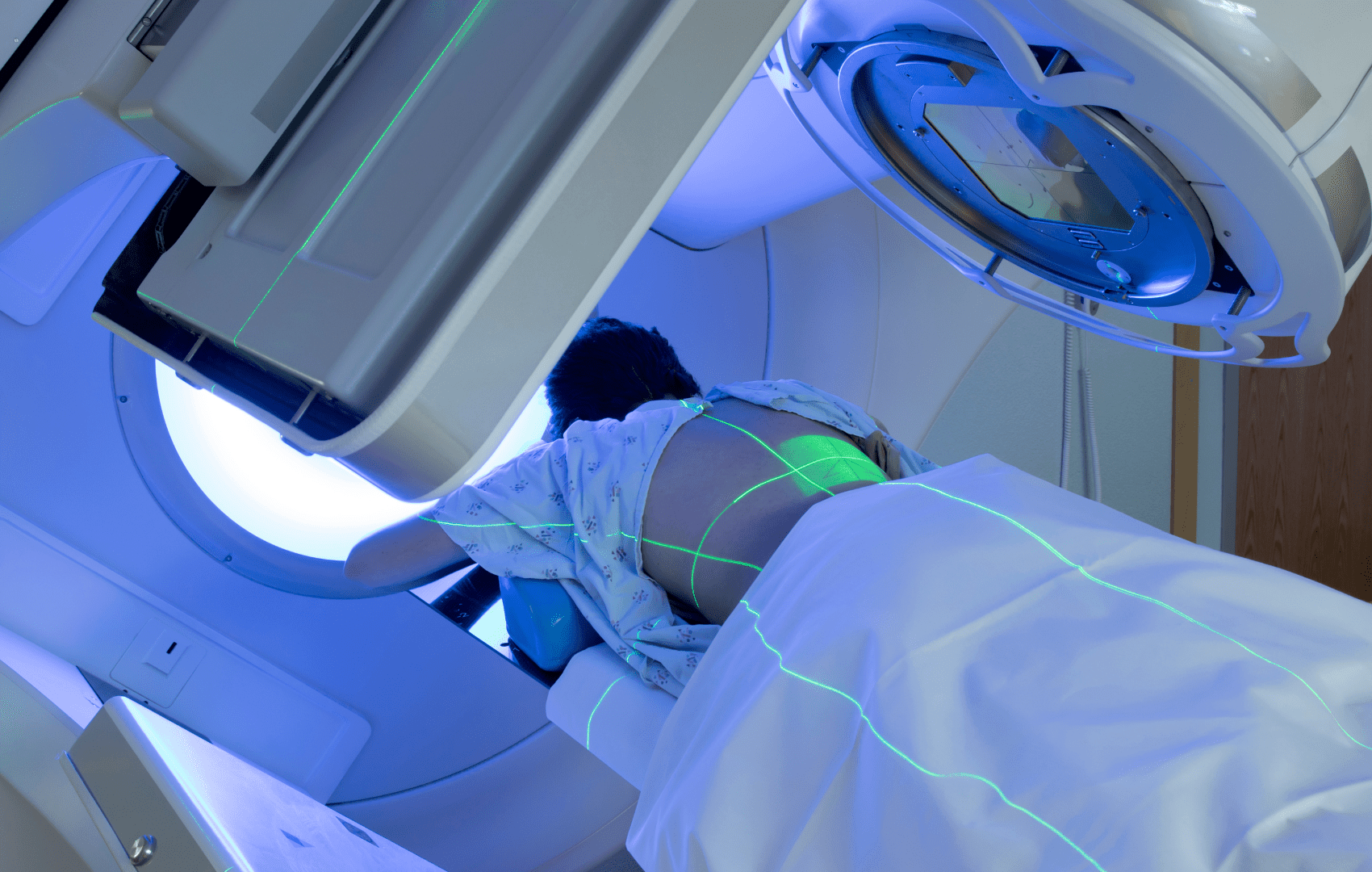 Tratamento para Linfoma de Hodgkin