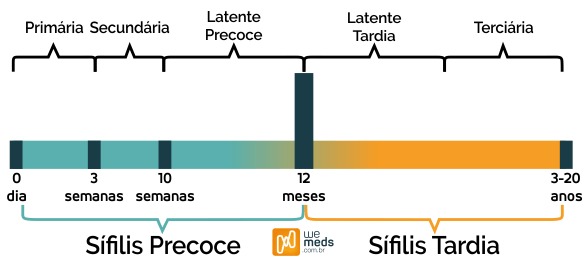 Sífilis
