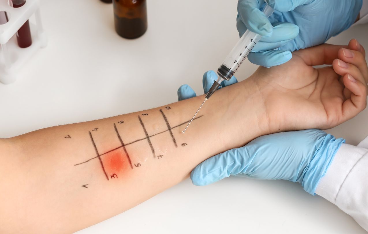 doagnostico doença de behcet