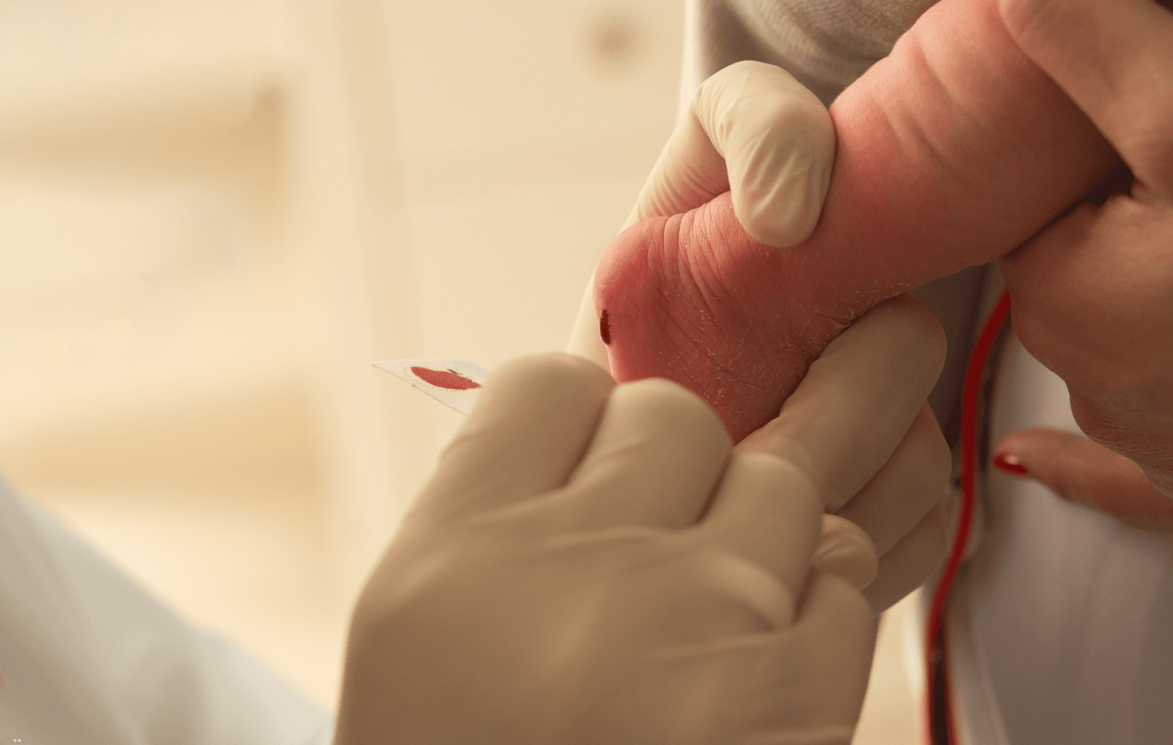 testes de triagem neonatal teste do pezinho