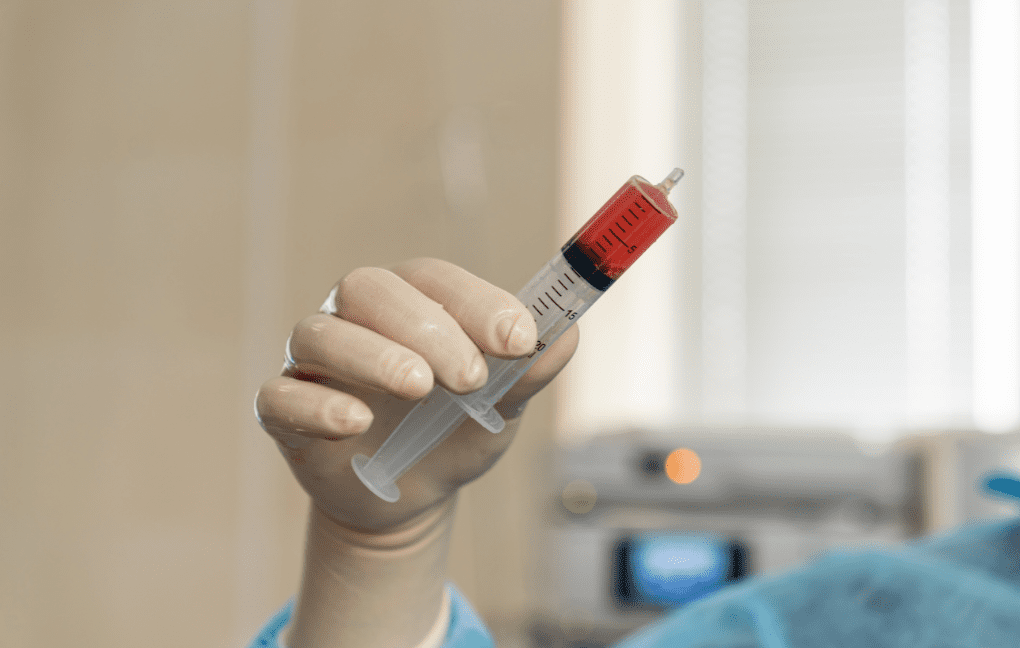 transplante de medula ossea