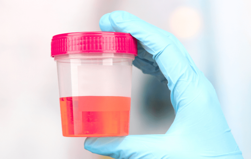 urina vermelha valrubicin