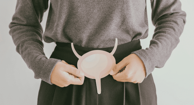 Tratamento intravesical com valrubicina amplia opções no câncer de bexiga