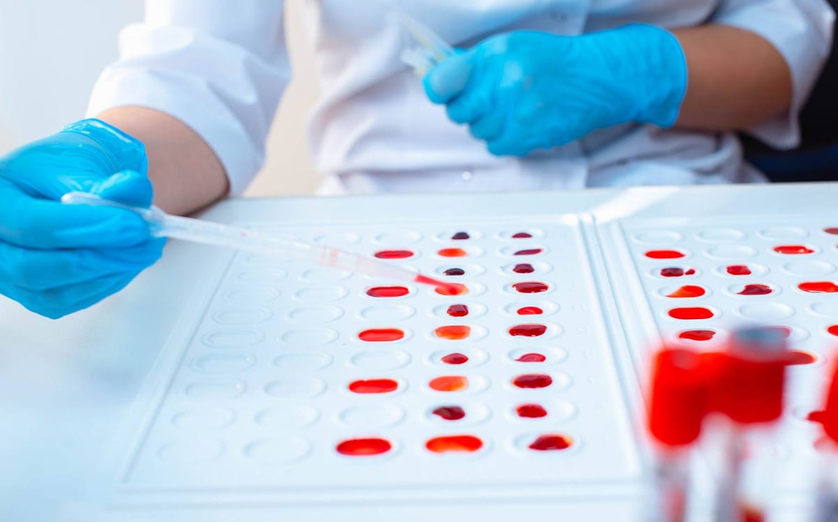 novo grupo sanguineo er sangue laboratorio