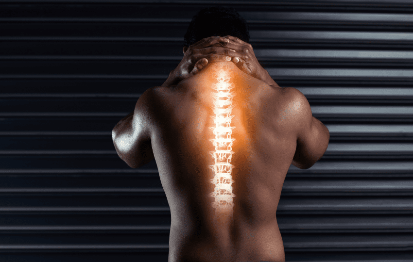 Síndrome de Compressão Medular