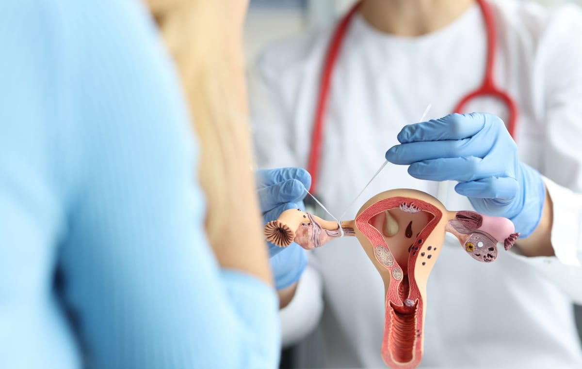 esterilização voluntaria