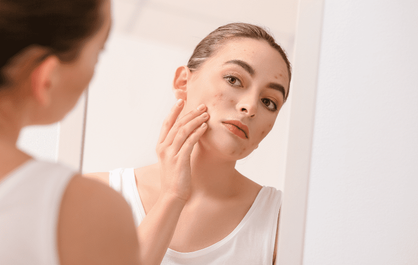 Celulite Facial, Periorbital e Orbital