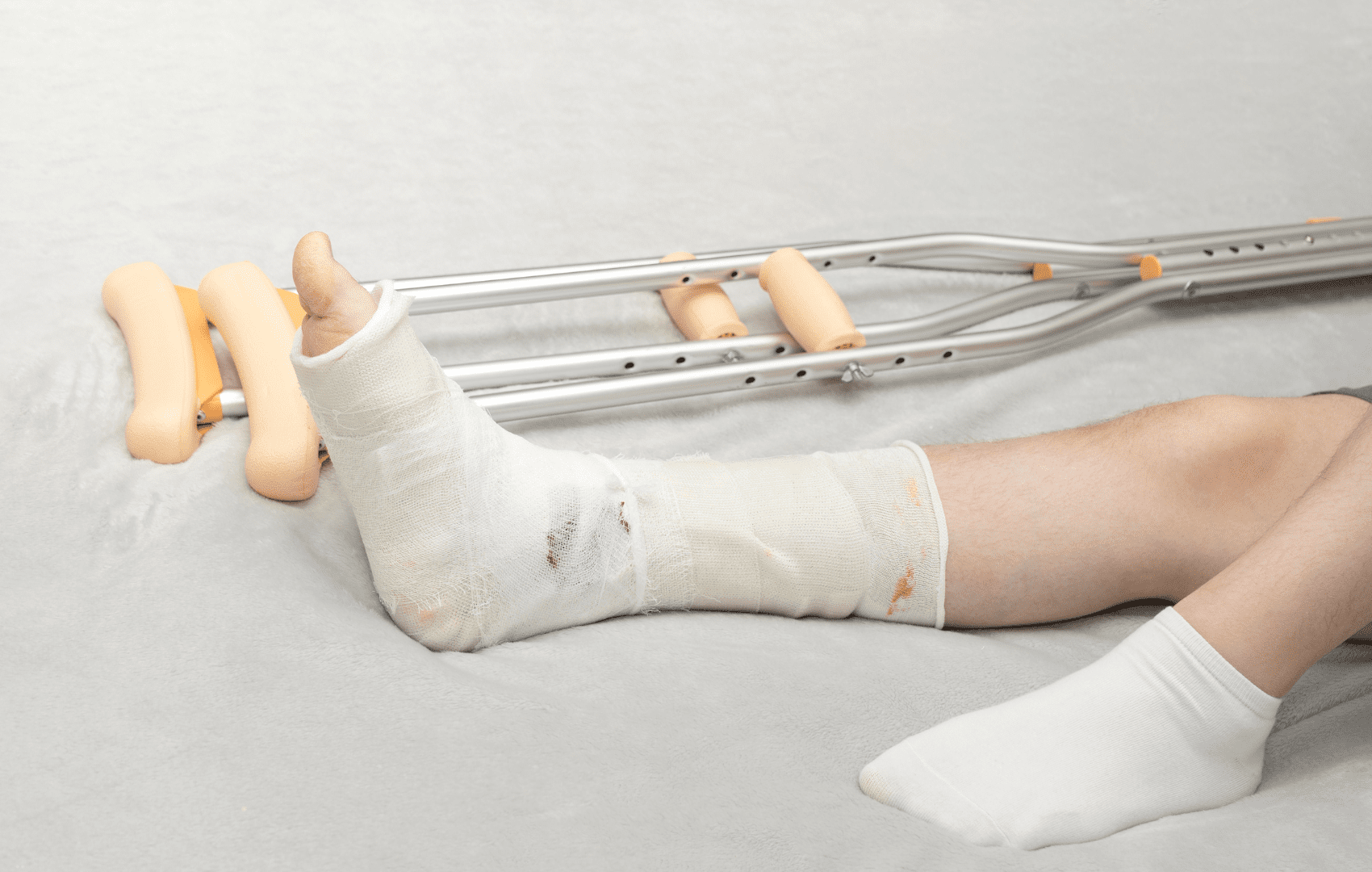 critérios de Gurd e Wilson