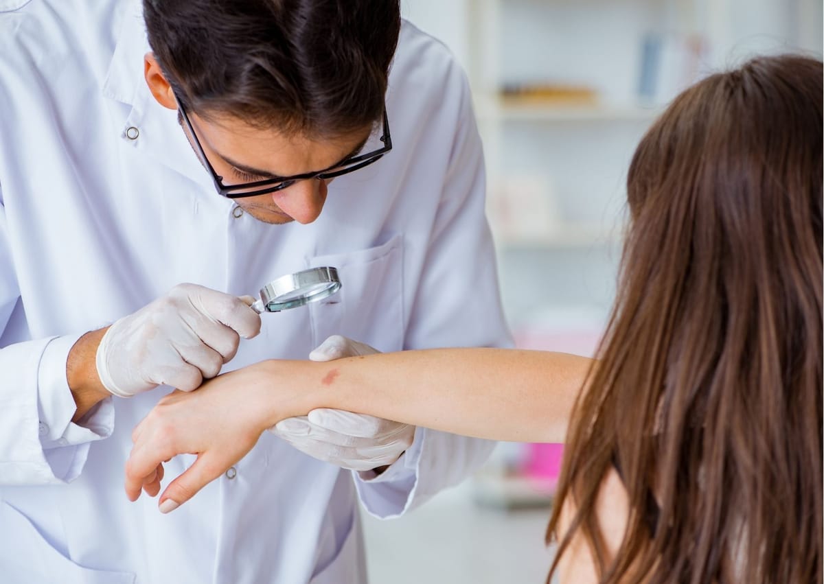 Pesquisadores descobrem um novo gene associado ao câncer de pele não melanoma