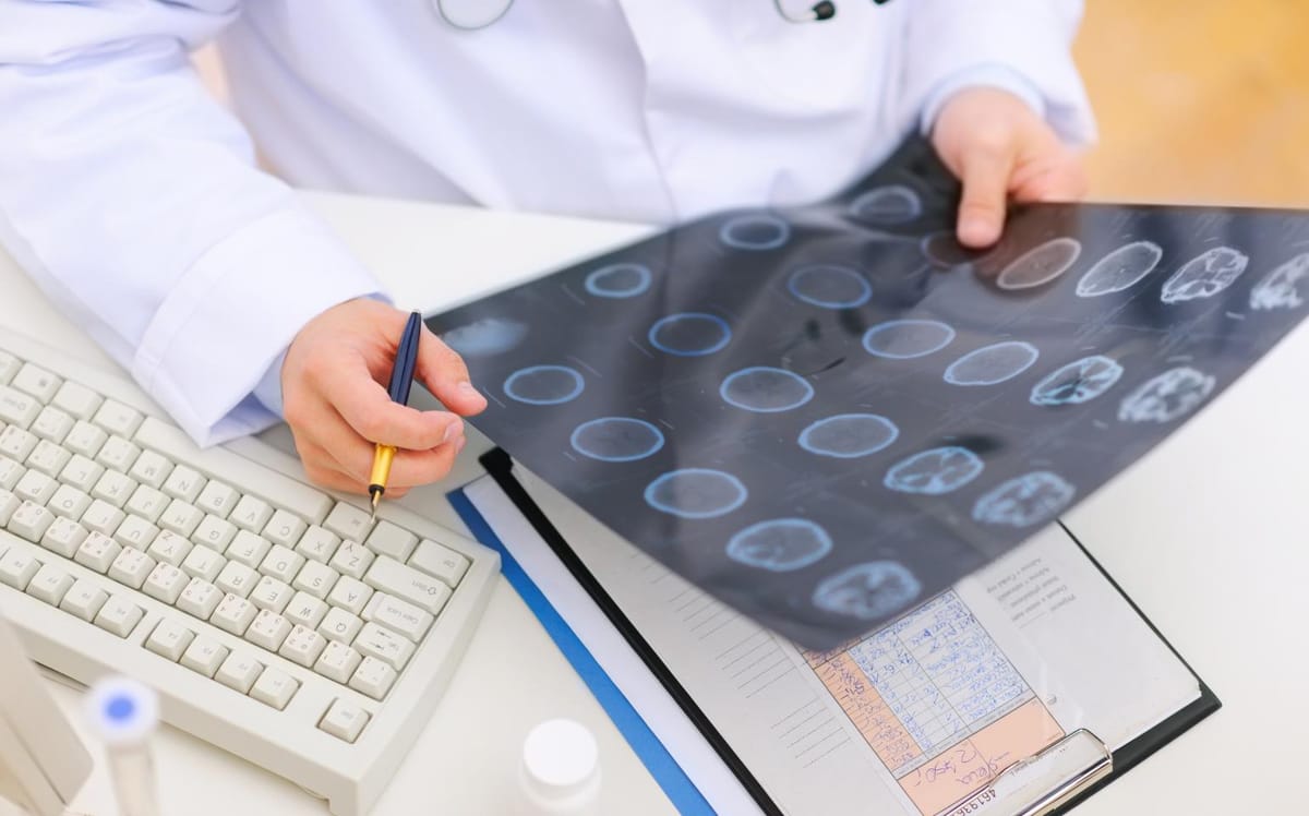 neurocisticercose exame da cabeça Como utilizar a Escala HUNT-HESS em pacientes com Hemorragia Subaracnoidea