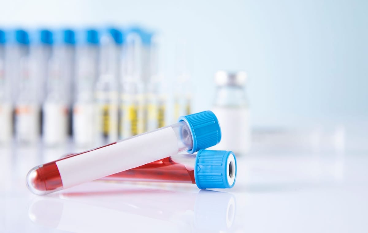 Antiestreptolisina O e a Infecção Estreptocócica