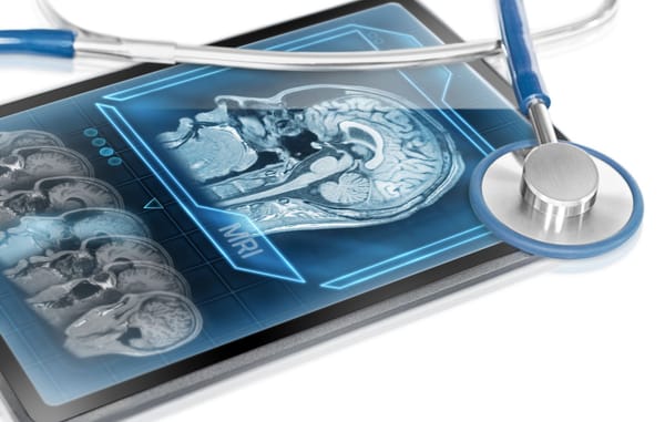 CHADS2 e CHA2DS2-VASC