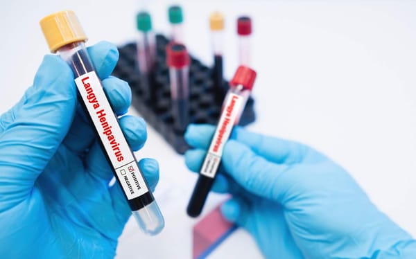 langya Langya henipavírus (LayV)