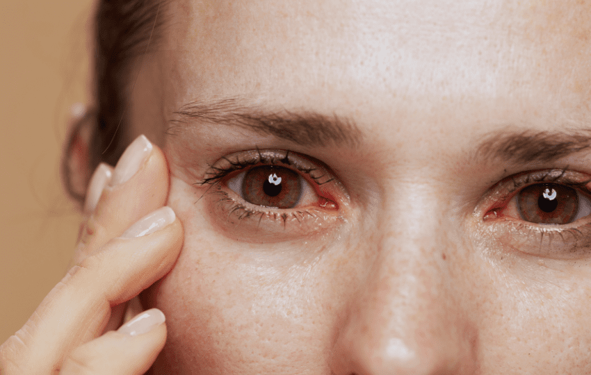 síndrome de sjögren