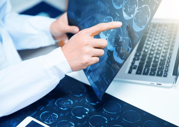 Ressonância Magnética de campo ultra baixo pode ser uma opção econômica