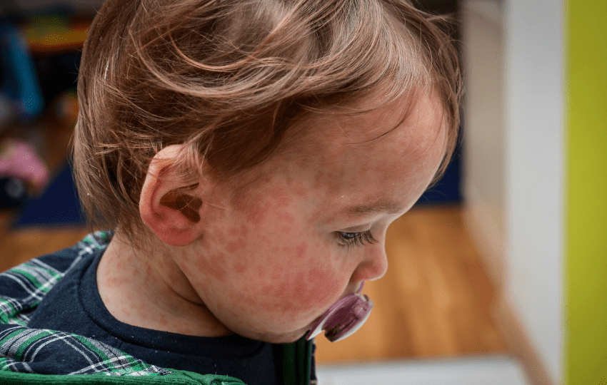 Emergência em saúde pública
