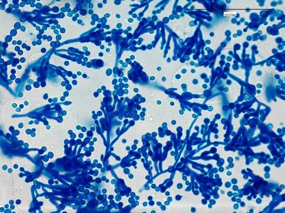 Scopulariopsis / Microascus