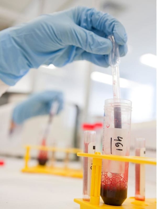 Sangue periférico como fonte de células tronco hematopoiéticas para transplante