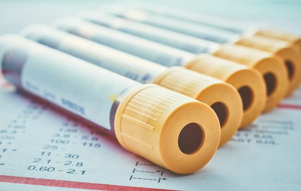 lactato desidrogenase DHEA e SDHEA